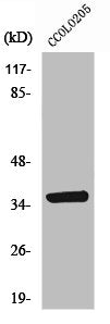 Western Blot analysis of COLO205 cells using AASD-PPT Polyclonal Antibody