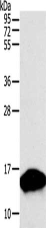 Gel: 12%SDS-PAGE, Lysate: 50 ug, Lane: Human fetal brain tissue, Primary antibody: CSB-PA648142(PVALB Antibody) at dilution 1/300, Secondary antibody: Goat anti rabbit IgG at 1/8000 dilution, Exposure time: 30 seconds