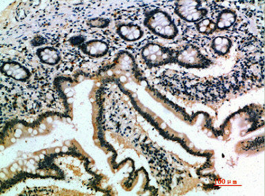 Immunohistochemical analysis of paraffin-embedded human-small-intestine, antibody was diluted at 1:200