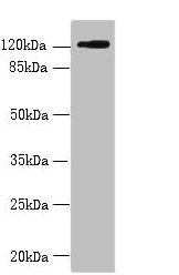Western blot All lanes: SLC4A8 antibody at 2µg/ml + Hela whole cell lysate Secondary Goat polyclonal to rabbit IgG at 1/10000 dilution Predicted band size: 123, 121, 118, 112, 78, 84, 72 kDa Observed band size: 123 kDa