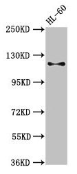 Western Blot Positive WB detected in: HL60 whole cell lysate All lanes: Cd163 antibody at 3µg/ml Secondary Goat polyclonal to rabbit IgG at 1/50000 dilution Predicted band size: 121, 126 kDa Observed band size: 121 kDa