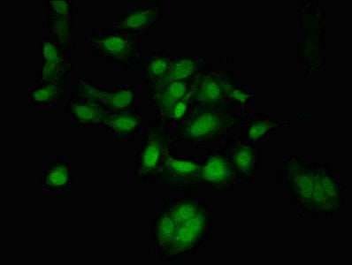 Immunofluorescent analysis of Hela cells using CSB-PA651478LA01HU at dilution of 1:100 and Alexa Fluor 488-congugated AffiniPure Goat Anti-Rabbit IgG(H+L)