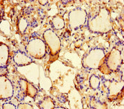 Immunohistochemistry of paraffin-embedded human thyroid tissue using CSB-PA652063LA01HU at dilution of 1:100