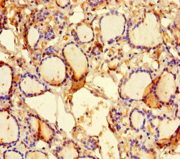 Immunohistochemistry of paraffin-embedded human thyroid tissue using CSB-PA652063LA01HU at dilution of 1:100
