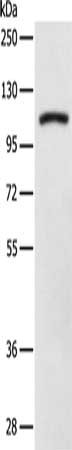 Gel: 8%SDS-PAGE, Lysate: 40 ug, Lane: Jurkat cells, Primary antibody: CSB-PA652501(DDX58 Antibody) at dilution 1/250, Secondary antibody: Goat anti rabbit IgG at 1/8000 dilution, Exposure time: 3 minutes