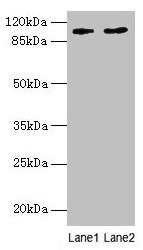Western blot All lanes: CCDC57 antibody at 1.2µg/ml Lane 1: PC-3 whole cell lysate Lane 2: HepG2 whole cell lysate Secondary Goat polyclonal to rabbit IgG at 1/10000 dilution Predicted band size: 104, 86 kDa Observed band size: 104 kDa