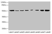 Western blot All lanes: PGS1 antibody at 2µg/ml Lane 1: Mouse liver tissue Lane 2: Hela whole cell lysate Lane 3: Jurkat whole cell lysate Lane 4: HepG2 whole cell lysate Lane 5: THP-1 whole cell lysate Lane 6: Mouse spleen tissue Lane 7: Mouse th...