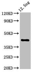 Western Blot Positive WB detected in Recombinant protein All lanes: ZAR1 antibody at 5.32ug/ml Secondary Goat polyclonal to rabbit IgG at 1/50000 dilution Predicted band size: 42 kDa Observed band size: 42 kDa