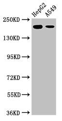 Western Blot Positive WB detected in: HepG2 whole cell lysate, A549 whole cell lysate All lanes: LRRK1 antibody at 3ug/ml Secondary Goat polyclonal to rabbit IgG at 1/50000 dilution Predicted band size: 226, 29 kDa Observed band size: 226 kDa