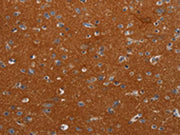 The image on the left is immunohistochemistry of paraffin-embedded Human brain tissue using CSB-PA655952(NOX3 Antibody) at dilution 1/40, on the right is treated with synthetic peptide. (Original magnification: ×200)