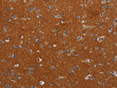 The image on the left is immunohistochemistry of paraffin-embedded Human brain tissue using CSB-PA655952(NOX3 Antibody) at dilution 1/40, on the right is treated with synthetic peptide. (Original magnification: ×200)