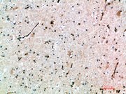 Immunohistochemical analysis of paraffin-embedded human-brain, antibody was diluted at 1:200