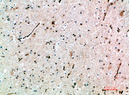 Immunohistochemical analysis of paraffin-embedded human-brain, antibody was diluted at 1:200