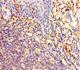 Immunohistochemistry of paraffin-embedded human tonsil tissue using CSB-PA659444LA01HU at dilution of 1:100