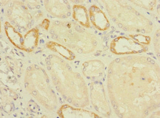 Immunohistochemistry of paraffin-embedded human kidney tissue using CSB-PA659452LA01HU at dilution of 1:100