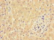 Immunohistochemistry of paraffin-embedded human liver tissue using CSB-PA659641LA01HU at dilution of 1:100