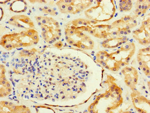 Immunohistochemistry of paraffin-embedded human kidney tissue using CSB-PA660753LA01HU at dilution of 1:100