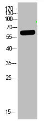 Western Blot analysis of HELA cells using primary antibody diluted at 1:2000(4°C overnight). Secondary antibody:Goat Anti-rabbit IgG IRDye 800( diluted at 1:5000, 25°C, 1 hour)