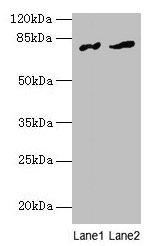 Western blot All lanes: FAM161A antibody at 8µg/ml Lane 1: Human placenta tissue Lane 2: Mouse liver tissue Secondary Goat polyclonal to rabbit IgG at 1/10000 dilution Predicted band size: 77, 65, 84 kDa Observed band size: 77 kDa