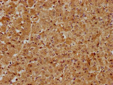 IHC image of CSB-PA662139LA01HU diluted at 1:400 and staining in paraffin-embedded human adrenal gland tissue performed on a Leica BondTM system. After dewaxing and hydration, antigen retrieval was mediated by high pressure in a citrate buffer (pH...
