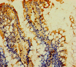 Immunohistochemistry of paraffin-embedded human small intestine tissue using CSB-PA663570LA01HU at dilution of 1:100