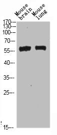 Western Blot analysis of mouse-brain mouse-lung cells using Beclin-1 Polyclonal Antibody diluted at 1:500. Secondary antibody was diluted at 1:20000