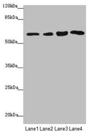 Western blot All lanes: FBXO7 antibody at 3.97µg/ml Lane 1: Mouse gonadal tissue Lane 2: Jurkat whole cell lysate Lane 3: 293T whole cell lysate Lane 4: PC-3 whole cell lysate Secondary Goat polyclonal to rabbit IgG at 1/10000 dilution Predicted b...