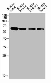 Western blot analysis of human blood lysate, antibody was diluted at 1000. Secondary antibody was diluted at 1:20000