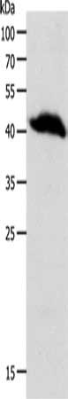 Gel: 10%SDS-PAGE, Lysate: 40 ug, Lane: Human liver cancer tissue, Primary antibody: CSB-PA668398(OPRL1 Antibody) at dilution 1/900, Secondary antibody: Goat anti rabbit IgG at 1/8000 dilution, Exposure time: 1 minute