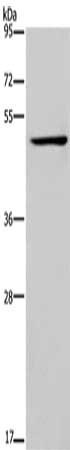 Gel: 8%SDS-PAGE, Lysate: 40 ug, Lane: Jurkat cells, Primary antibody: CSB-PA668482(IRF4 Antibody) at dilution 1/400, Secondary antibody: Goat anti rabbit IgG at 1/8000 dilution, Exposure time: 2 minutes