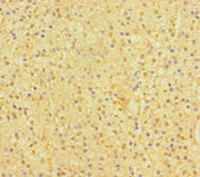 Immunohistochemistry of paraffin-embedded human adrenal gland tissue using CSB-PA668784LA01HU at dilution of 1:100