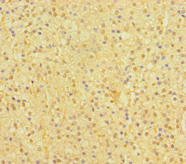 Immunohistochemistry of paraffin-embedded human adrenal gland tissue using CSB-PA668784LA01HU at dilution of 1:100