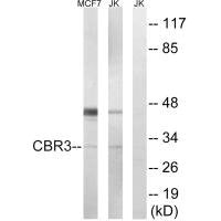 Western blot analysis of extracts from MCF7 cells and Jurkat cells, using CBR3 antibody.