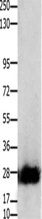 Gel: 10%SDS-PAGE, Lysate: 30 ug, Lane: Mouse pancreas tissue, Primary antibody: CSB-PA669859(CLDN14 Antibody) at dilution 1/200, Secondary antibody: Goat anti rabbit IgG at 1/8000 dilution, Exposure time: 50 seconds