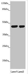 Western blot All lanes: MTERFD3 antibody at 1.66 ug/ml Lane 1: U251 whole cell lysate Lane 2: HepG2 whole cell lysate Secondary Goat polyclonal to rabbit IgG at 1/10000 dilution Predicted band size: 44 kDa Observed band size: 44 kDa