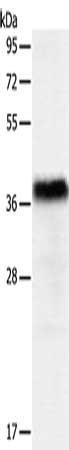 Gel: 10%SDS-PAGE, Lysate: 40 ug, Lane: Human liver cancer tissue, Primary antibody: CSB-PA670407(PGBD2 Antibody) at dilution 1/550, Secondary antibody: Goat anti rabbit IgG at 1/8000 dilution, Exposure time: 10 seconds