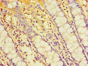 Immunohistochemistry of paraffin-embedded human colon tissue using CSB-PA670962ESR1HU at dilution of 1:100