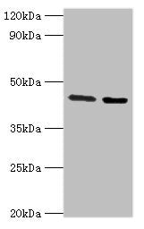 Western blot All lanes: CHRFAM7A antibody at 3ug/ml Lane 1: Jurkat whole cell lysate Lane 2: Rat liver tissue Secondary Goat polyclonal to rabbit IgG at 1/10000 dilution Predicted band size: 46 kDa Observed band size: 46 kDa