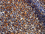 The image on the left is immunohistochemistry of paraffin-embedded Human tonsil tissue using CSB-PA671607(BIRC6 Antibody) at dilution 1/50, on the right is treated with synthetic peptide. (Original magnification: ×200)