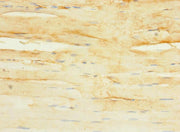 Immunohistochemistry of paraffin-embedded human skeletal muscle tissue using CSB-PA672077LA01HU at dilution of 1:100