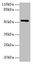 Western blot All lanes: CCDC14 antibody at 2µg/ml + Jurkat whole cell lysate Secondary Goat polyclonal to rabbit IgG at 1/10000 dilution Predicted band size: 107, 84, 89, 52, 102 kDa Observed band size: 52 kDa