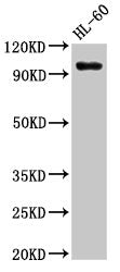 Western Blot Positive WB detected in: HL60 whole cell lysate All lanes: KMT5B antibody at 3µg/ml Secondary Goat polyclonal to rabbit IgG at 1/50000 dilution Predicted band size: 100, 45, 32 kDa Observed band size: 100 kDa