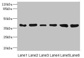 Western blot All lanes: TIMM50 antibody at 4.05µg/ml Lane 1: Rat heart tissue Lane 2: MM231 whole cell lysate Lane 3: MCF-7 whole cell lysate Lane 4: Hela whole cell lysate Lane 5: 293T whole cell lysate Lane 6: HepG2 whole cell lysate Secondary G...
