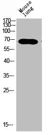 Western blot analysis of mouse-lung mouse-brain mouse-kidney mouse-heart lysate, antibody was diluted at 500. Secondary antibody was diluted at 1:20000