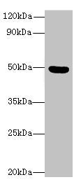Western blot All lanes: C5orf22 antibody at 8µg/ml + Mouse brain tissue Secondary Goat polyclonal to rabbit IgG at 1/10000 dilution Predicted band size: 50, 21, 19 kDa Observed band size: 50 kDa
