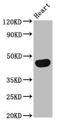 Western Blot Positive WB detected in: Rat heart tissue All lanes: TRDMT1 antibody at 4ug/ml Secondary Goat polyclonal to rabbit IgG at 1/50000 dilution Predicted band size: 45, 42, 40, 7, 8, 13 kDa Observed band size: 45 kDa