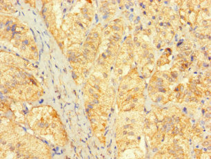 Immunohistochemistry of paraffin-embedded human adrenal gland tissue using CSB-PA676570LA01HU at dilution of 1:100