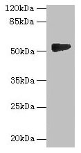 Western blot All lanes: GTDC1 antibody at 4µg/ml + A549 whole cell lysate Secondary Goat polyclonal to rabbit IgG at 1/10000 dilution Predicted band size: 53, 44, 34, 50, 38 kDa Observed band size: 53 kDa