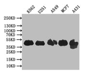Western Blot Positive WB detected in: K562 whole cell lysate, U251 whole cell lysate, A549 whole cell lysate, MCF7 whole cell lysate, A431 whole cell lysate All lanes: VPS26B antibody at 1:1000 Secondary Goat polyclonal to rabbit IgG at 1/50000 di...