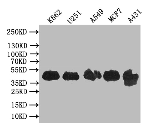 Western Blot Positive WB detected in: K562 whole cell lysate, U251 whole cell lysate, A549 whole cell lysate, MCF7 whole cell lysate, A431 whole cell lysate All lanes: VPS26B antibody at 1:1000 Secondary Goat polyclonal to rabbit IgG at 1/50000 di...